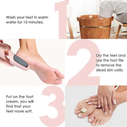 Rechargeable Electric Callus Remover – Smooth, Soft Heels Anytime