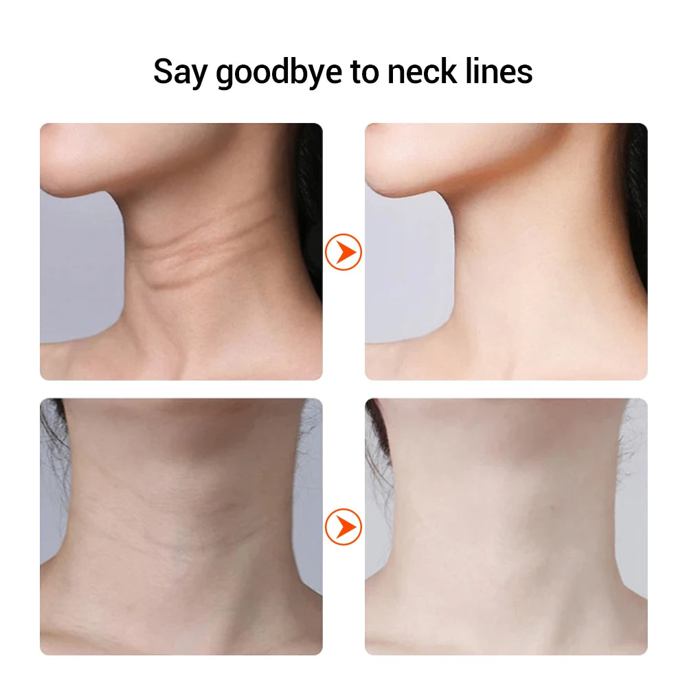 Neck & Face Beauty Device – 3-Colour LED Skin Tightening & Wrinkle Remover